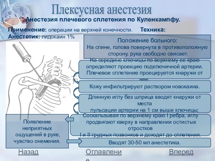 Плексусная анестезия Анестезия плечевого сплетения по Куленкампфу. Применение: операции на верхней