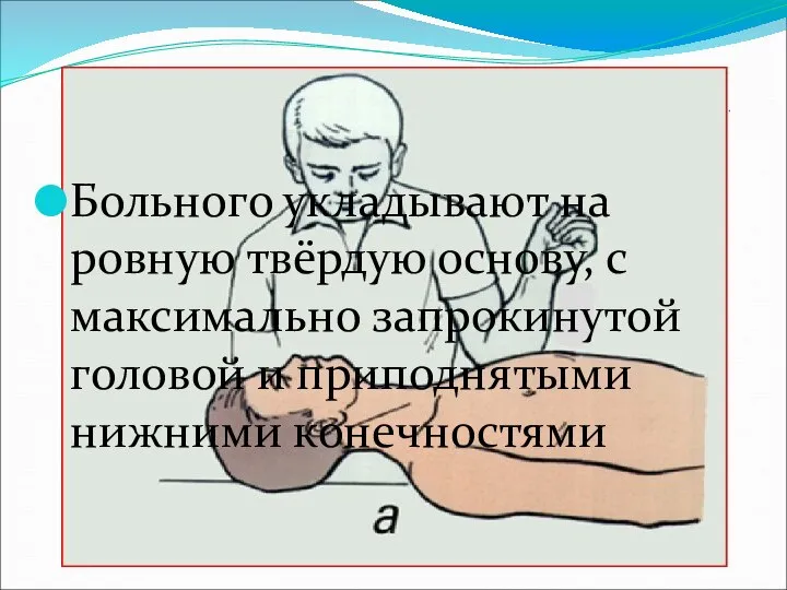 Больного укладывают на ровную твёрдую основу, с максимально запрокинутой головой и приподнятыми нижними конечностями