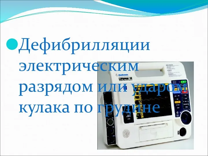 Дефибрилляции электрическим разрядом или ударом кулака по грудине