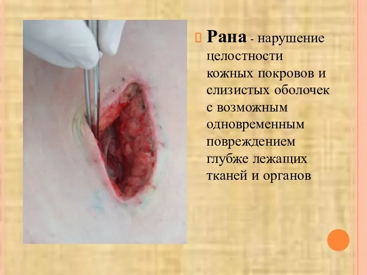 Рана - нарушение целостности кожных покровов и слизистых оболочек с возможным