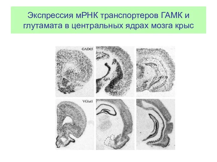 Экспрессия мРНК транспортеров ГАМК и глутамата в центральных ядрах мозга крыс