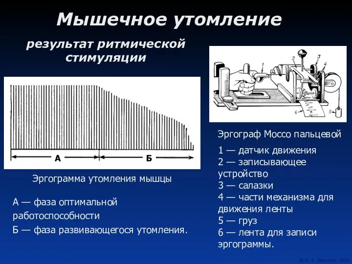 Мышечное утомление Эргограф Моссо пальцевой 1 — датчик движения 2 —