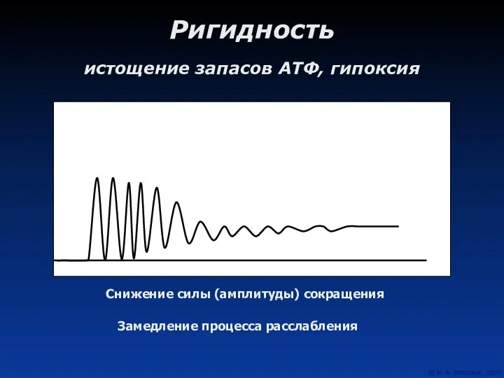 Ригидность истощение запасов АТФ, гипоксия Снижение силы (амплитуды) сокращения Замедление процесса расслабления