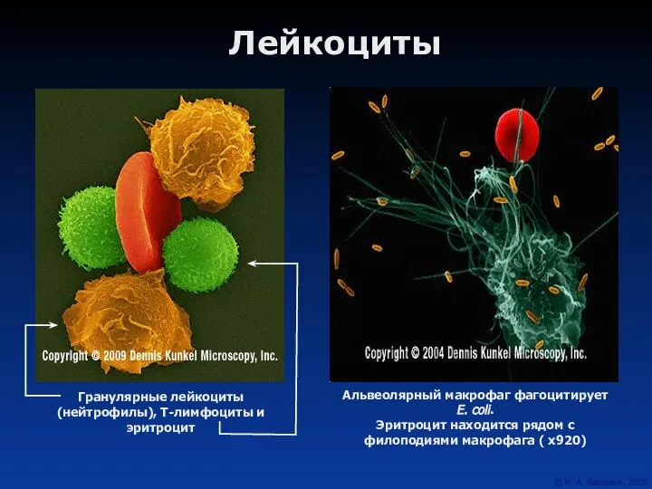 Лейкоциты Альвеолярный макрофаг фагоцитирует E. coli. Эритроцит находится рядом с филоподиями