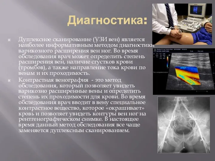 Диагностика: Дуплексное сканирование (УЗИ вен) является наиболее информативным методом диагностики варикозного