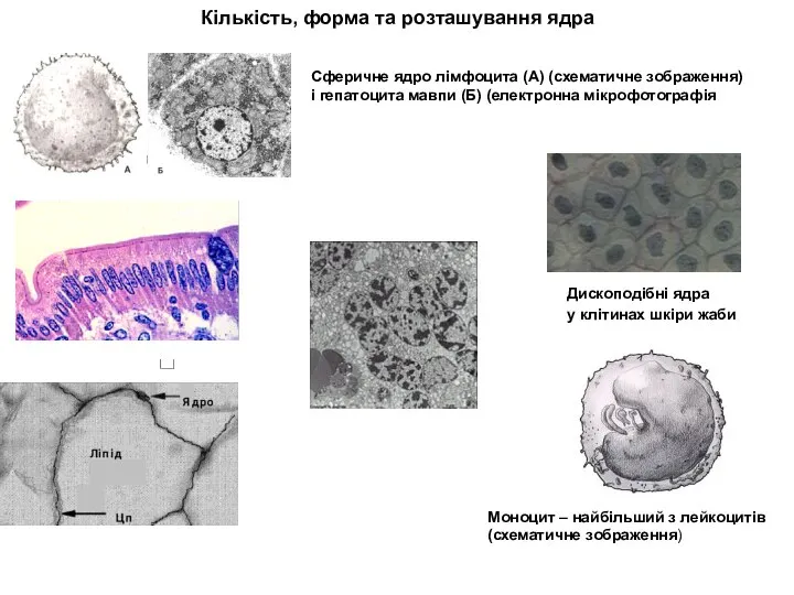 Кількість, форма та розташування ядра Сферичне ядро лімфоцита (А) (схематичне зображення)