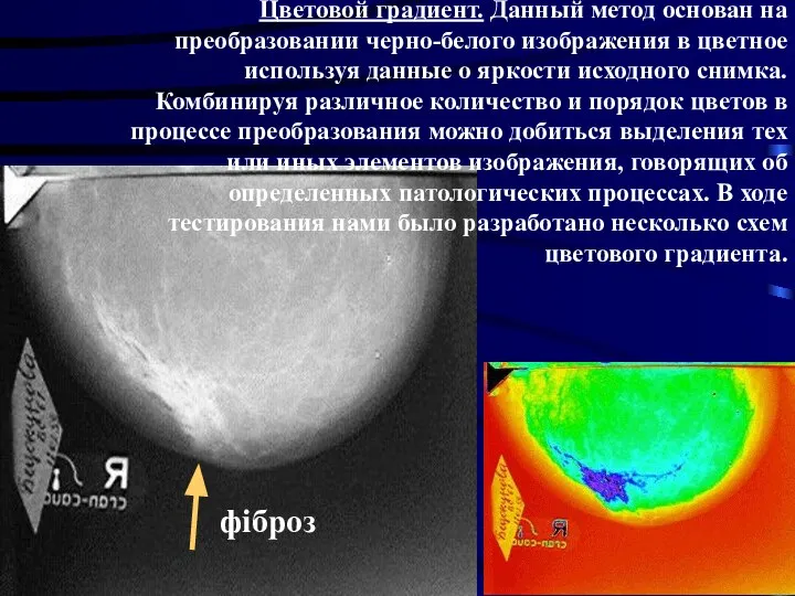 Цветовой градиент. Данный метод основан на преобразовании черно-белого изображения в цветное