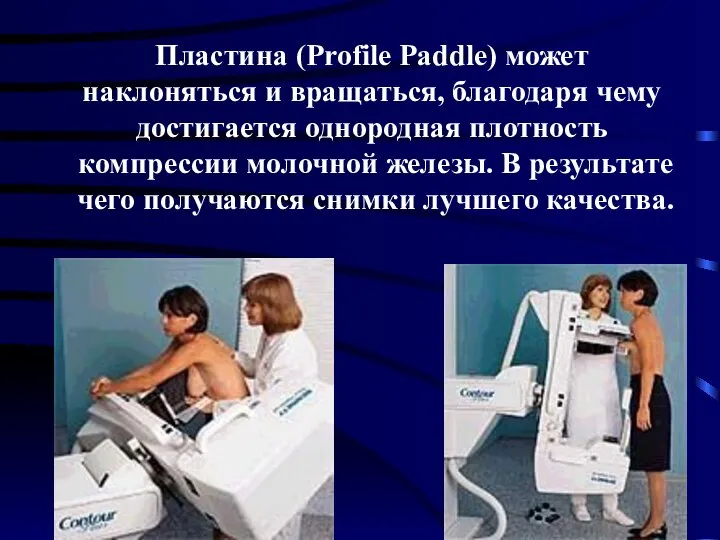 Пластина (Profile Paddle) может наклоняться и вращаться, благодаря чему достигается однородная