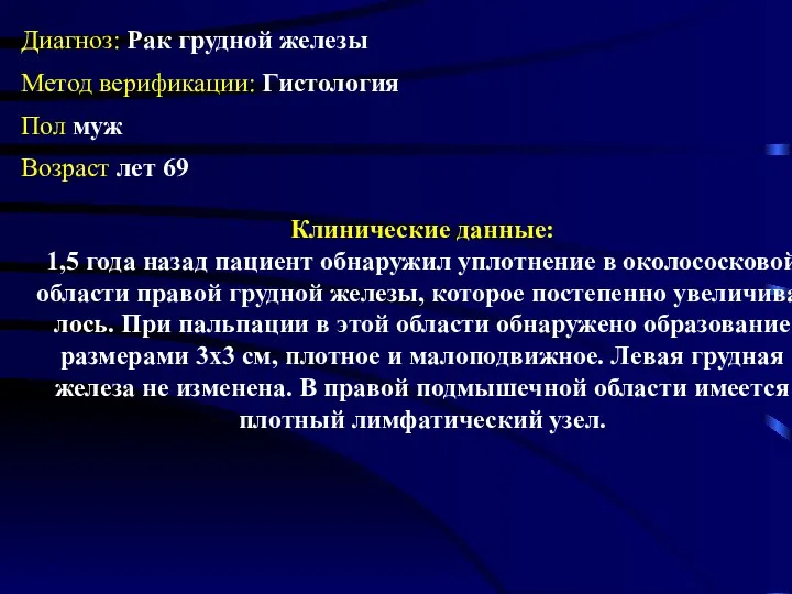 Диагноз: Рак грудной железы Метод верификации: Гистология Пол муж Возраст лет