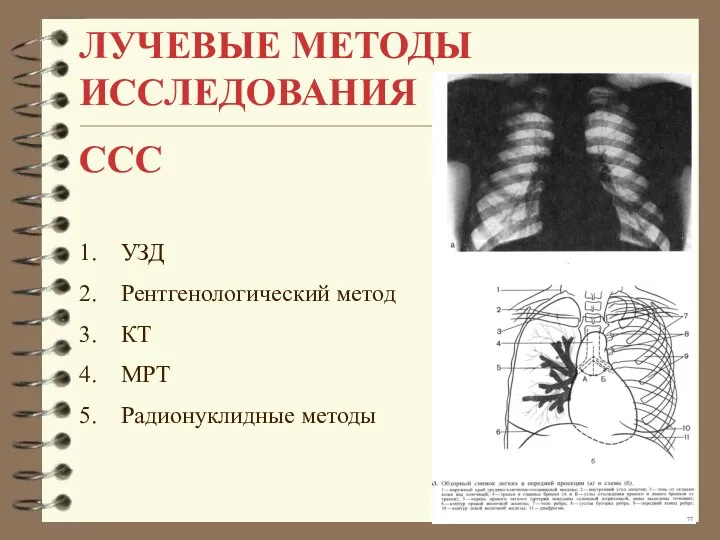 ЛУЧЕВЫЕ МЕТОДЫ ИССЛЕДОВАНИЯ ССС УЗД Рентгенологический метод КТ МРТ Радионуклидные методы