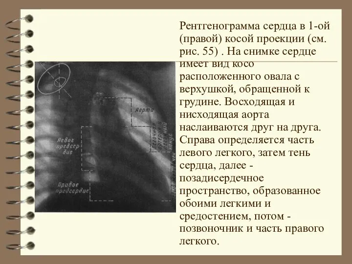 Рентгенограмма сердца в 1-ой (правой) косой проекции (см. рис. 55) .