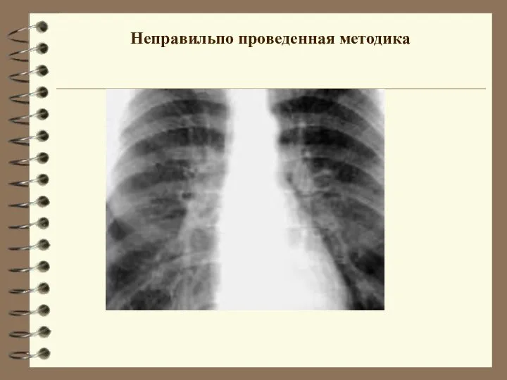 Неправильпо проведенная методика