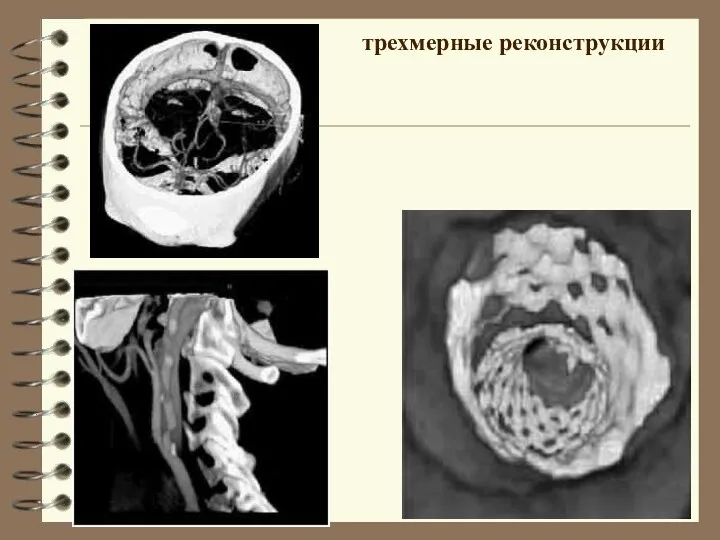 трехмерные реконструкции