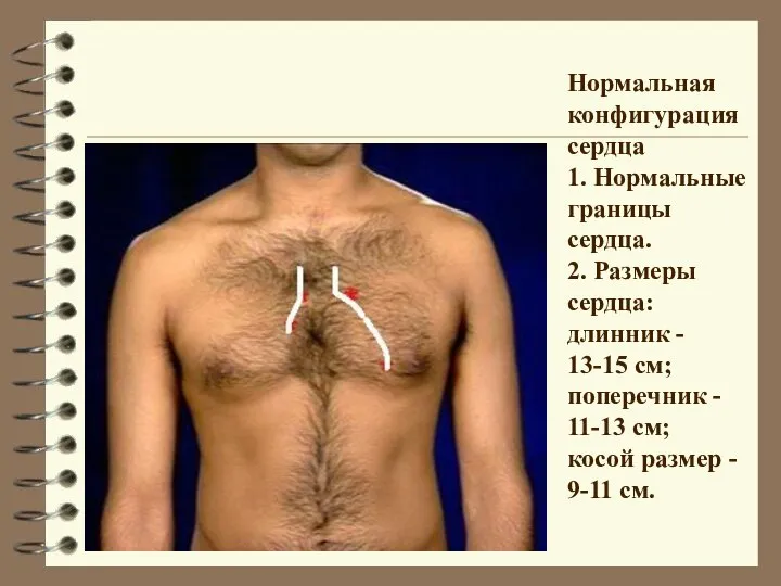 Нормальная конфигурация сердца 1. Нормальные границы сердца. 2. Размеры сердца: длинник
