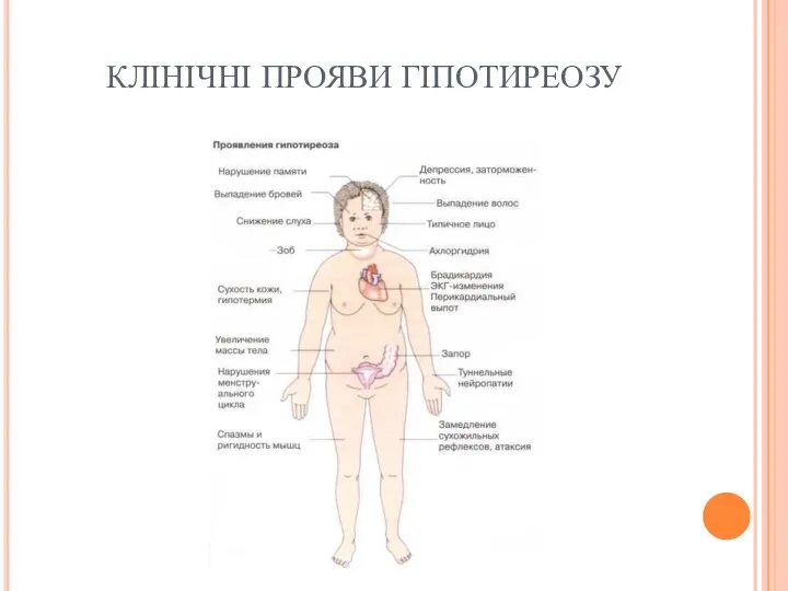 КЛІНІЧНІ ПРОЯВИ ГІПОТИРЕОЗУ