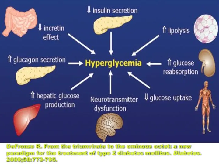 DeFronzo R. From the triumvirate to the ominous octet: a new