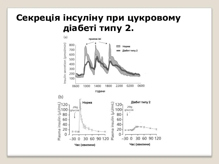 Секреція інсуліну при цукровому діабеті типу 2.