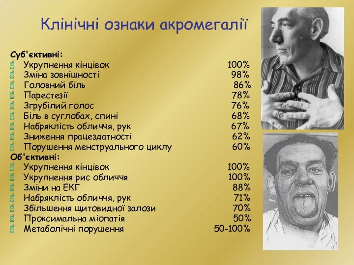 Клінічні ознаки акромегалії Суб'єктивні: Укрупнення кінцівок 100% Зміна зовнішності 98% Головний