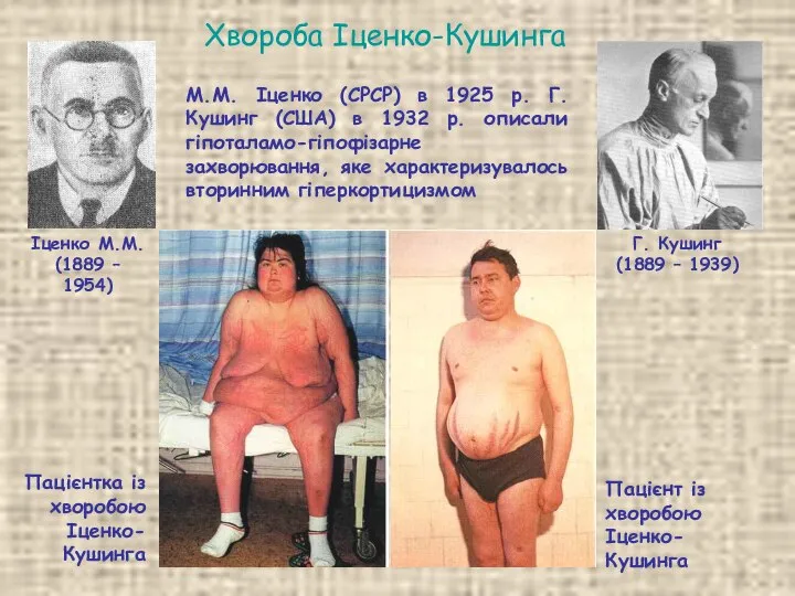 Хвороба Іценко-Кушинга М.М. Іценко (СРСР) в 1925 р. Г. Кушинг (США)
