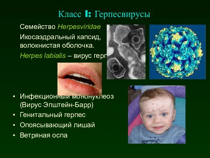 Класс I: Герпесвирусы Семейство Herpesviridae Икосаэдральный капсид, волокнистая оболочка. Herpes labialis