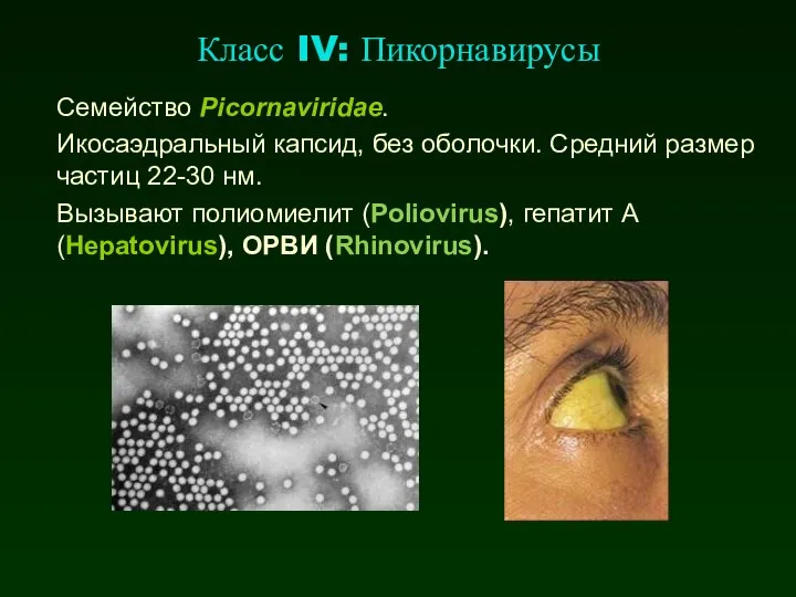 Класс IV: Пикорнавирусы Семейство Picornaviridae. Икосаэдральный капсид, без оболочки. Средний размер