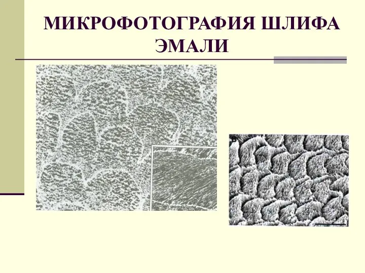 МИКРОФОТОГРАФИЯ ШЛИФА ЭМАЛИ