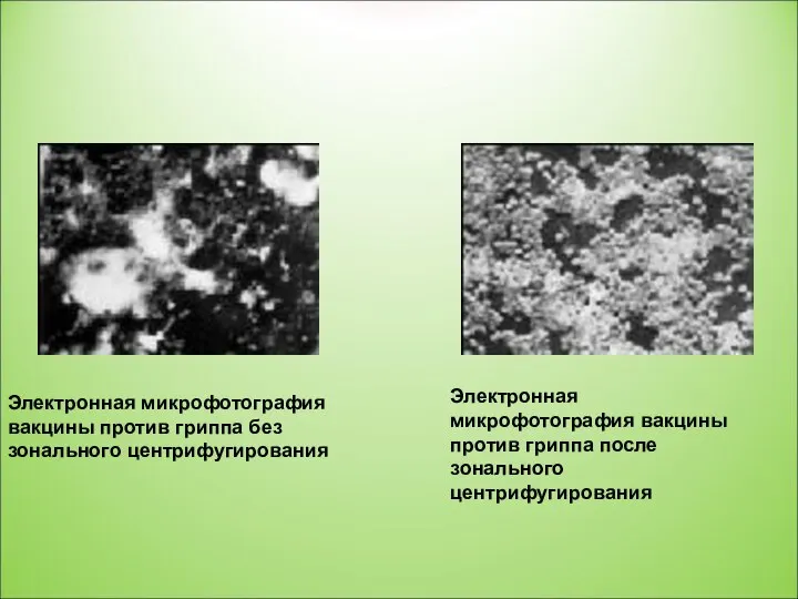 Электронная микрофотография вакцины против гриппа без зонального центрифугирования Электронная микрофотография вакцины против гриппа после зонального центрифугирования