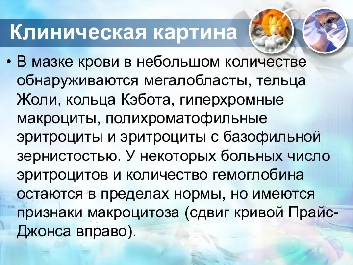 В мазке крови в небольшом количестве обнаруживаются мегалобласты, тельца Жоли, кольца