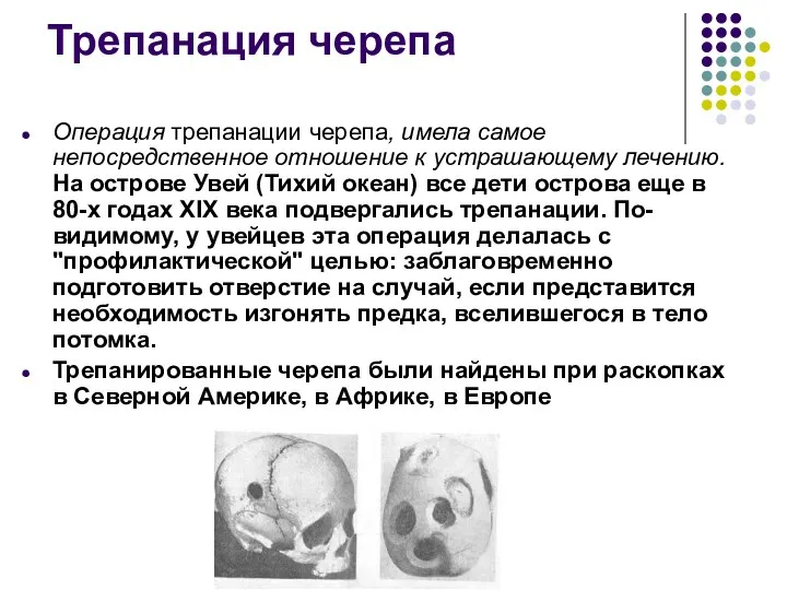 Трепанация черепа Операция трепанации черепа, имела самое непосредственное отношение к устрашающему