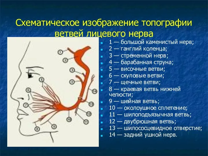 Схематическое изображение топографии ветвей лицевого нерва 1 — большой каменистый нерв;