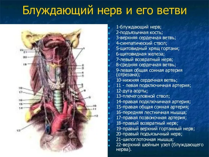 Блуждающий нерв и его ветви 1-блуждающий нерв; 2-подъязычная кость; 3-верхняя сердечная