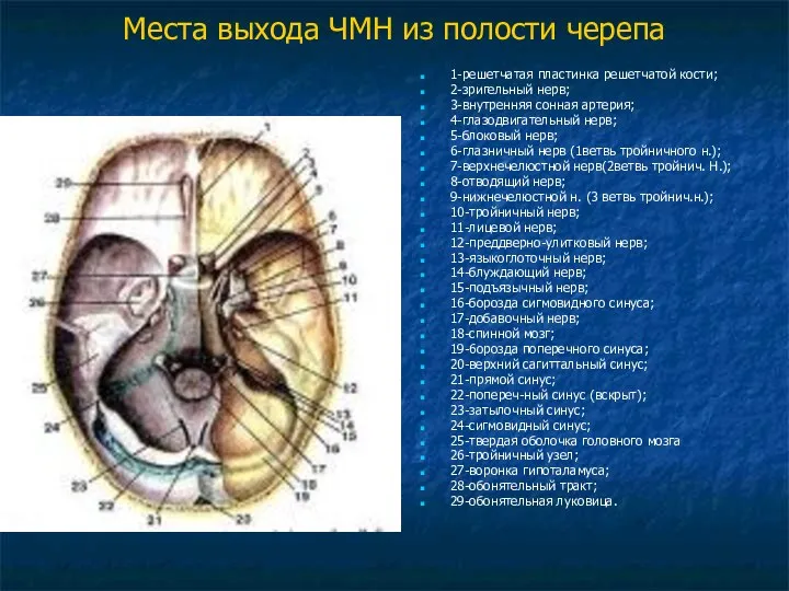 Места выхода ЧМН из полости черепа 1-решетчатая пластинка решетчатой кости; 2-зригельный