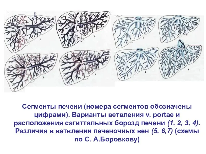 Сегменты печени (номера сегментов обозначены цифрами). Варианты ветвления v. portae и