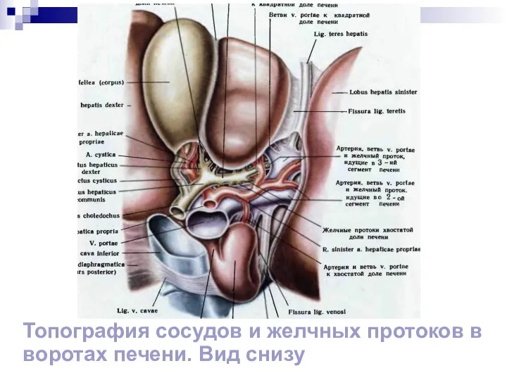 Топография сосудов и желчных протоков в воротах печени. Вид снизу