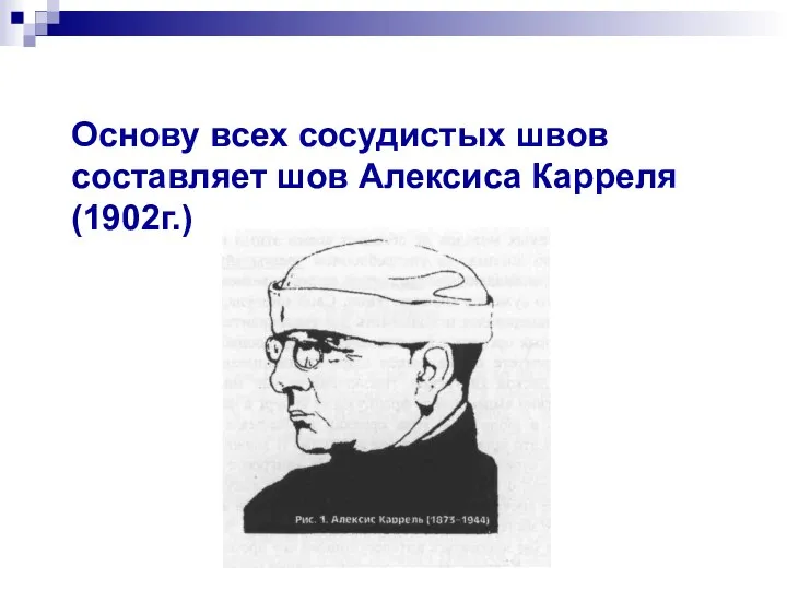 Основу всех сосудистых швов составляет шов Алексиса Карреля (1902г.)