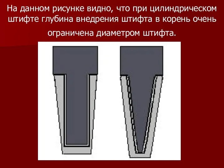 На данном рисунке видно, что при цилиндрическом штифте глубина внедрения штифта