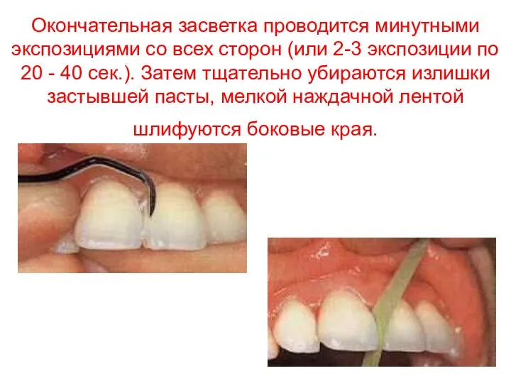 Окончательная засветка проводится минутными экспозициями со всех сторон (или 2-3 экспозиции