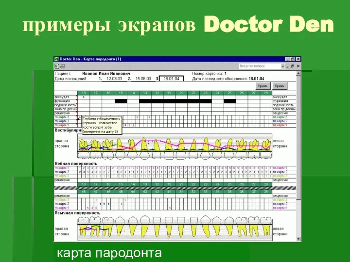 примеры экранов Doctor Den карта пародонта