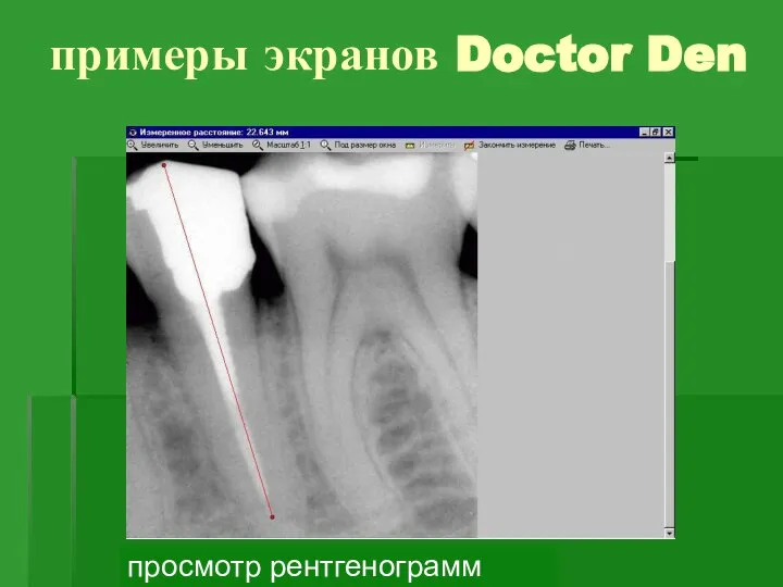 примеры экранов Doctor Den просмотр рентгенограмм