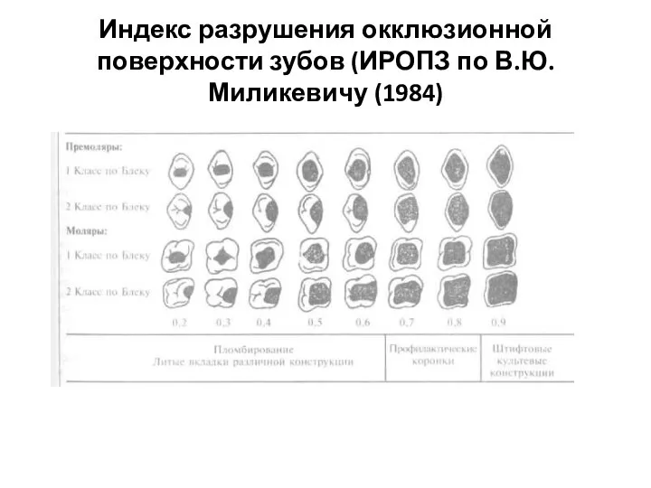 Индекс разрушения окклюзионной поверхности зубов (ИРОПЗ по В.Ю.Миликевичу (1984)