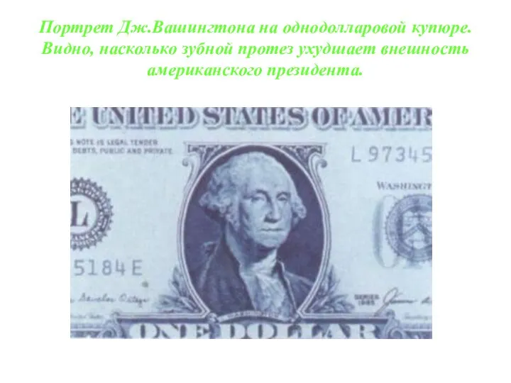 Портрет Дж.Вашингтона на однодолларовой купюре. Видно, насколько зубной протез ухудшает внешность американского президента.