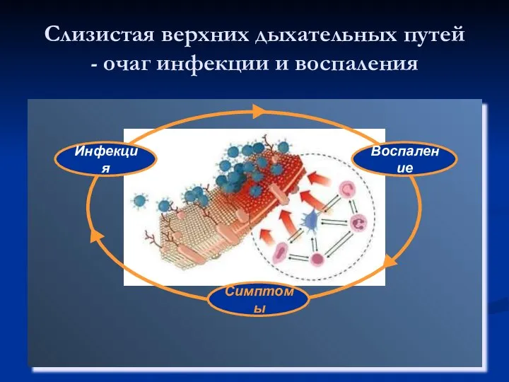 Слизистая верхних дыхательных путей - очаг инфекции и воспаления