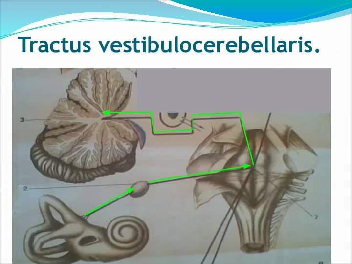 Tractus vestibulocerebellaris.