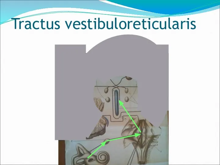 Tractus vestibuloreticularis