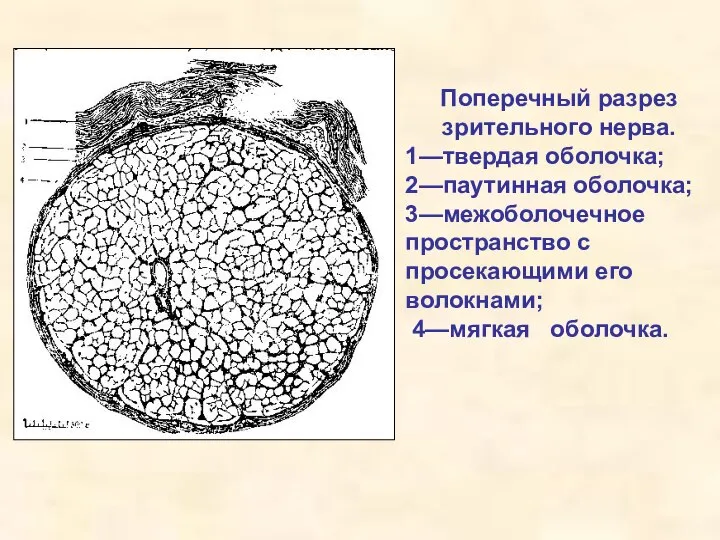 Поперечный разрез зрительного нерва. 1—твердая оболочка; 2—паутинная оболочка; 3—межоболочечное пространство с просекающими его волокнами; 4—мягкая оболочка.