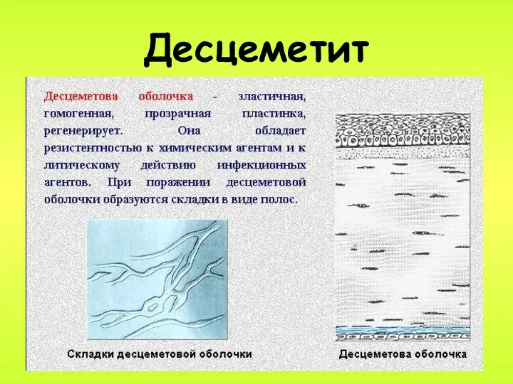 Десцеметит