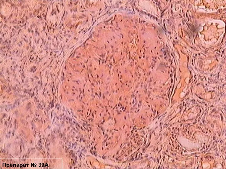 Препарат № 39А