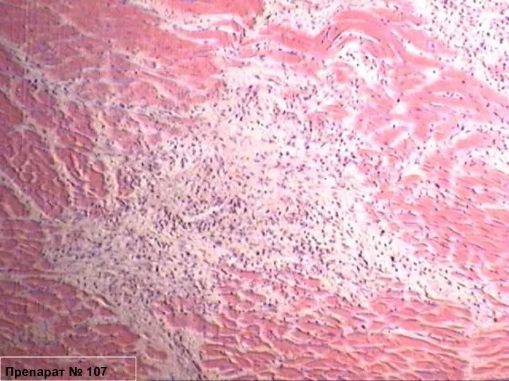 Препарат № 107