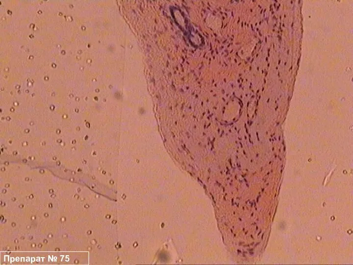 Препарат № 75