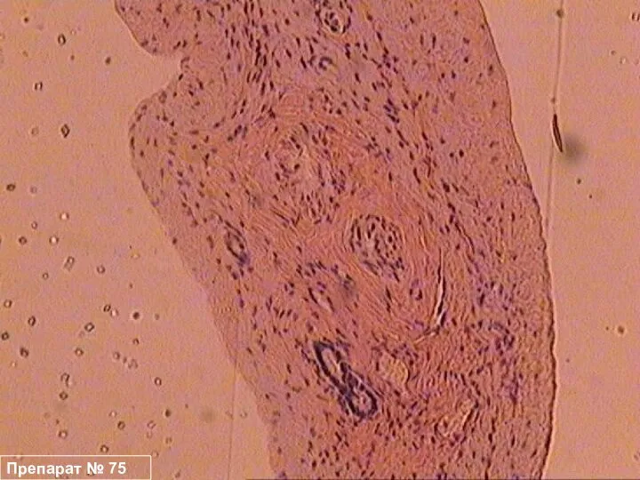 Препарат № 75